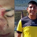 La Loma: Imputado por lesionar gravemente a un árbitro