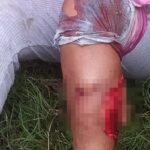 Brutal ataque de un perro pitbull a una joven en Tartagal, canallesca actitud de los dueños del animal